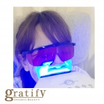 (gratify)セルフホワイトニング