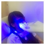 （plus）セルフホワイトニング☆