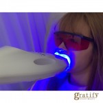 (gratify)ホワイトニング