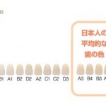 （plus)日本人の平均の歯の白さ