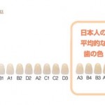 （plus)日本人の平均の歯の白さ